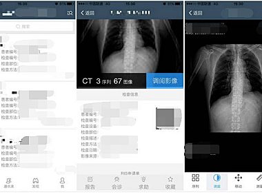 专注医学影像的数据管理和协作，医众构建了基于SaaS的云服务模式